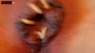 У женщины из пизды выползают черви, опарыши и прочие ползучие твари